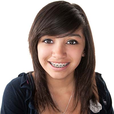 Orthodontics Near Me in Oxnard CA
