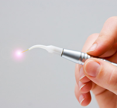 Odontología Láser Cerca de Mí en Oxnard, CA